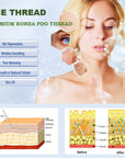 ACE PDO thread - 360R Bidirection Cog Cannula W type (100pcs)